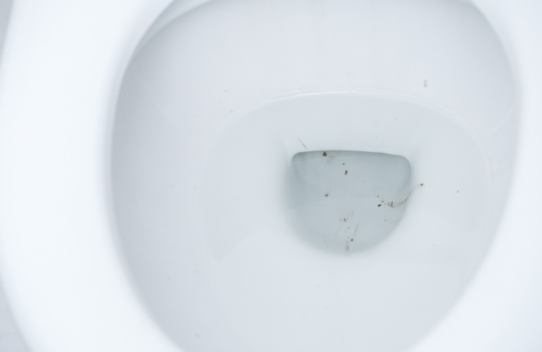 【頑固な黒ずみもスッキリ】トイレに黒ずみができる原因と効果的な掃除手順とは？